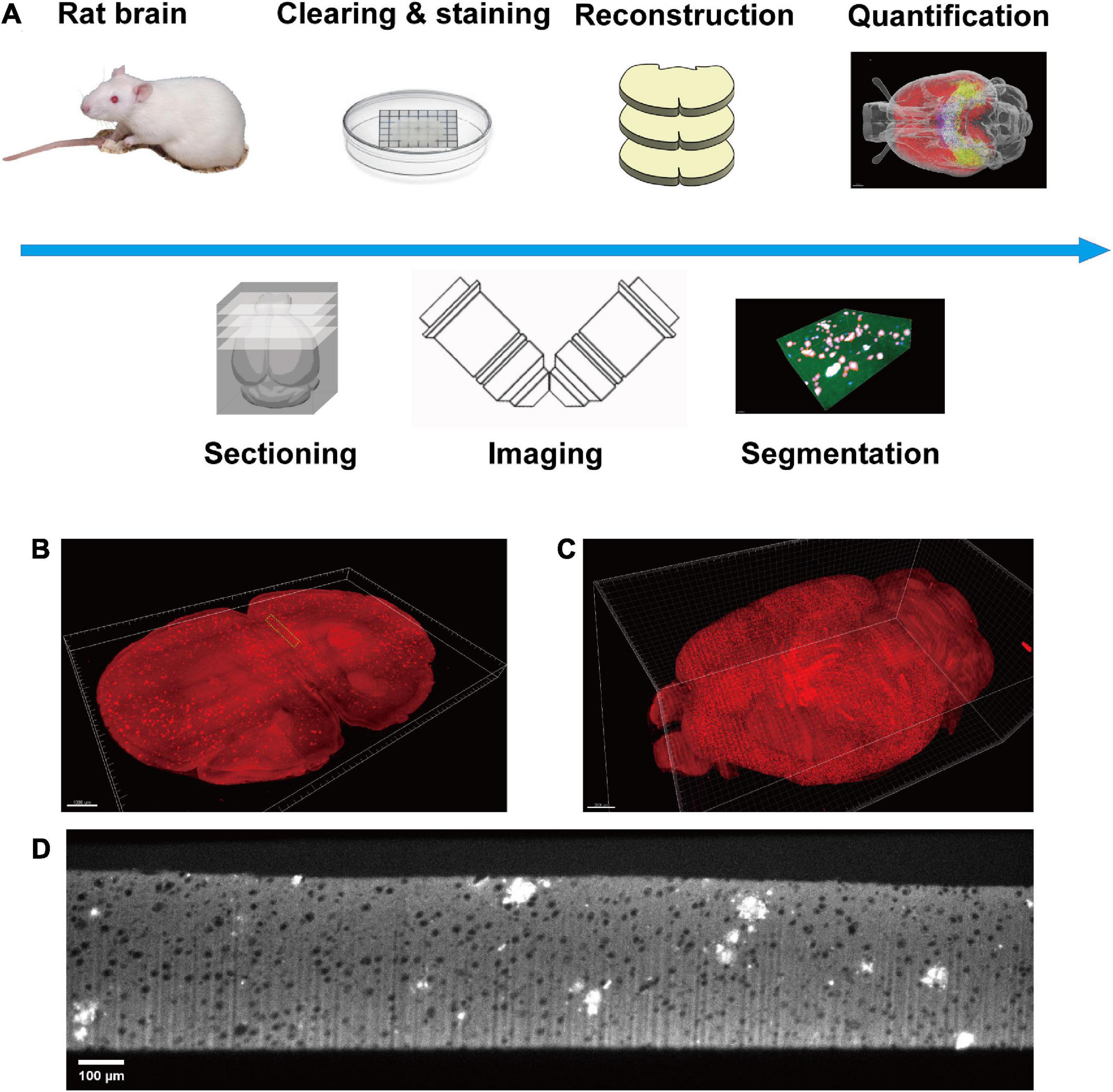 Weakly supervised learning analysis of Aβ plaque distribution in the whole rat brain